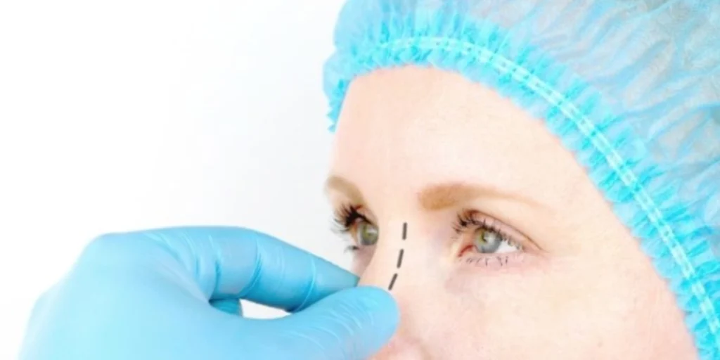 Septoplasty Surgery in Dubai