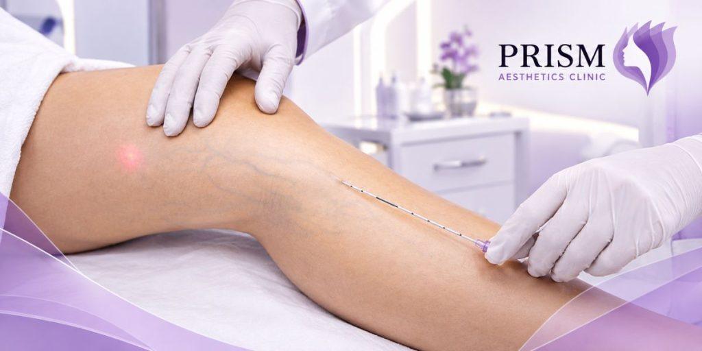Vascular Surgery in Dubai & Abu Dhabi